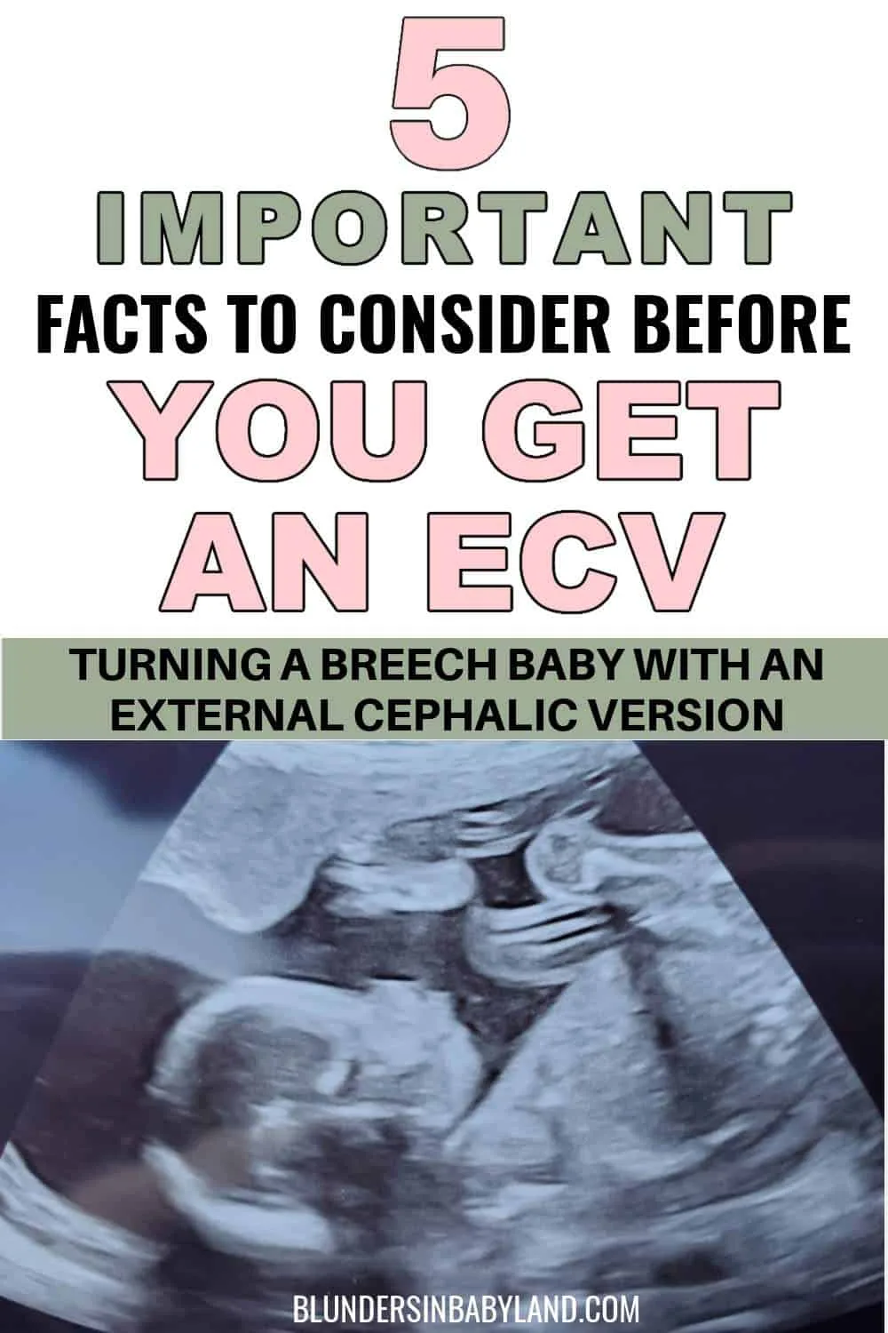 Benefits and Risks of ECV - External Cephalic Version (1)