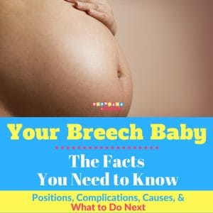 Your Breech Baby - Facts You Need to Know about Positions, Complications, and Causes of a Breech Baby
