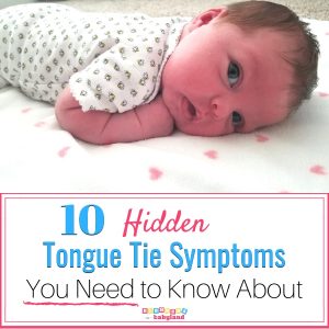 10 Hidden Tongue Tie Symptoms You Need to Know About--