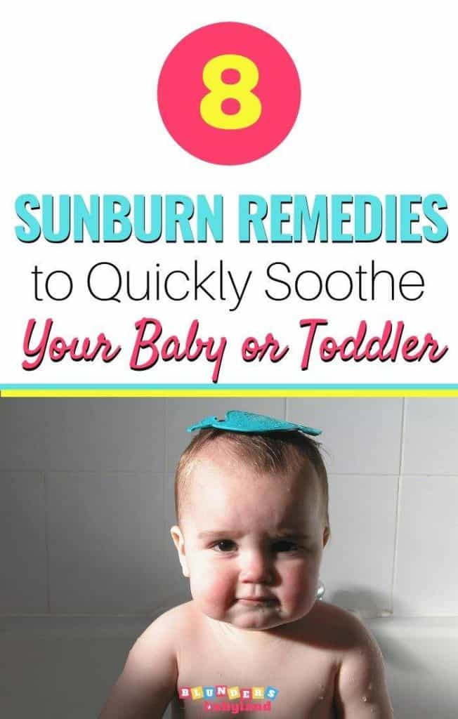 Baby Sunburn Remedies - Baby Sunburn Treatment