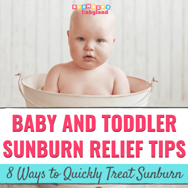 Baby and Toddler Sunburn Relief Tips