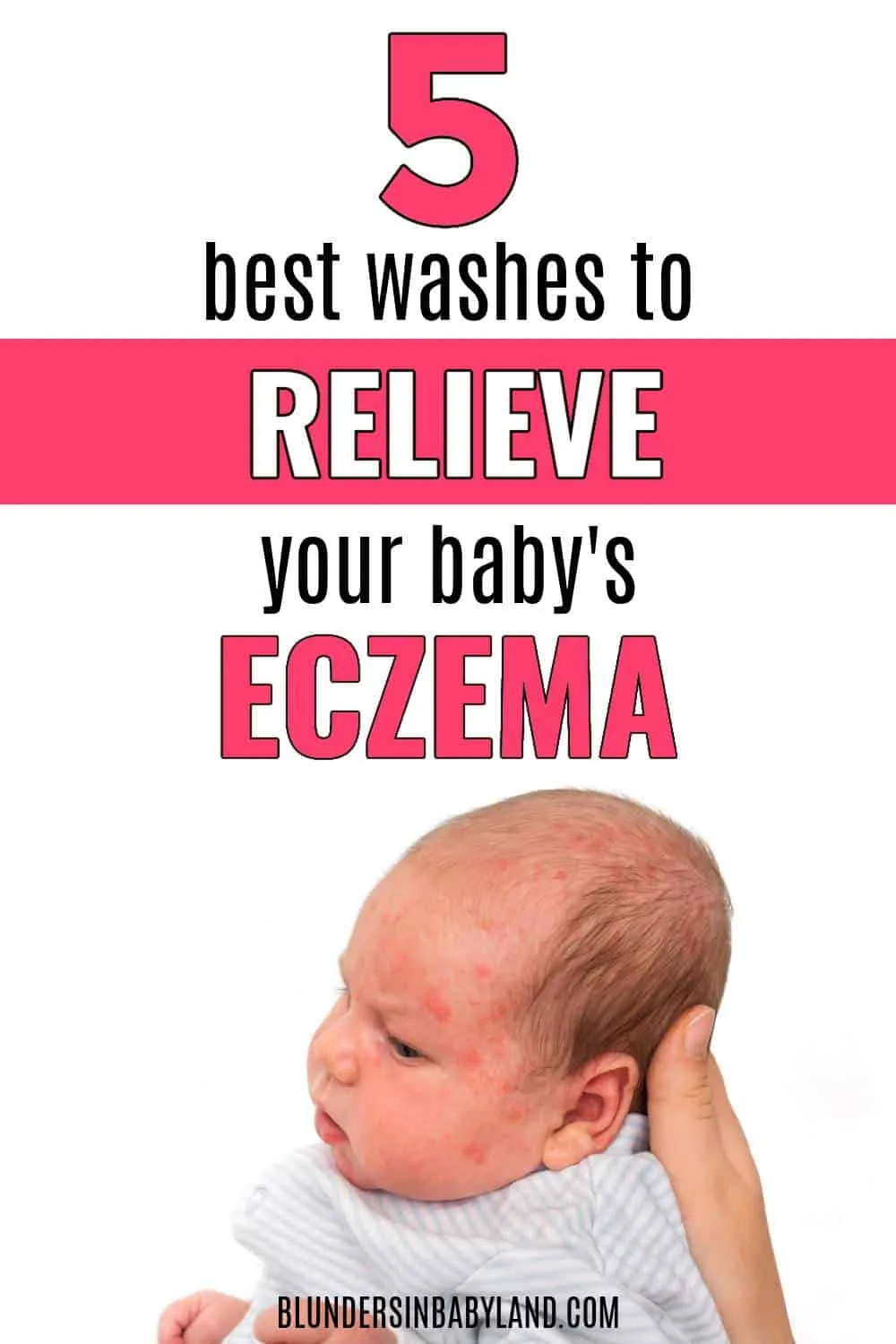 BEST WASHES FOR BABY ECZEMA (1)