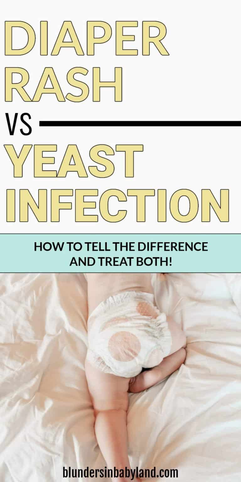 Diaper Rash Vs Yeast Infection How To Tell The Difference Treat Both